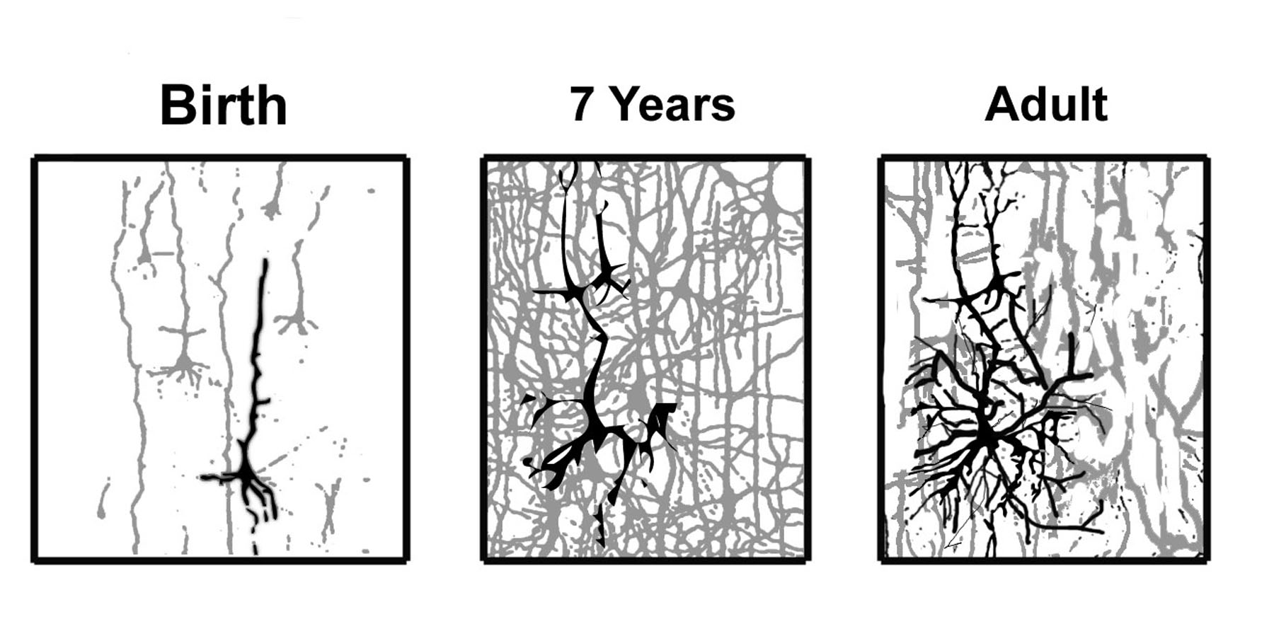 Nerve cells shown thinning out but getting more complex with age